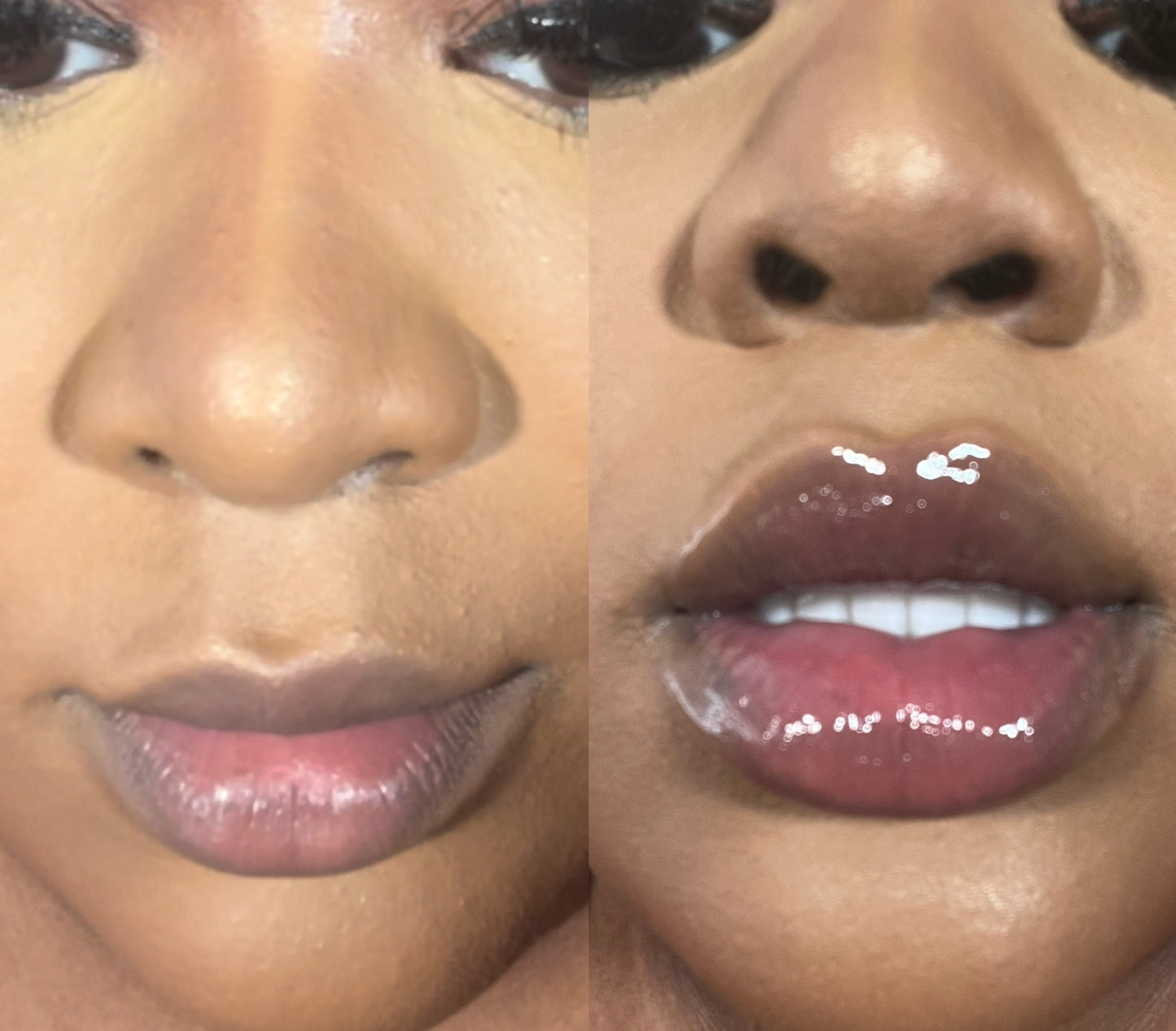 Lip Juice