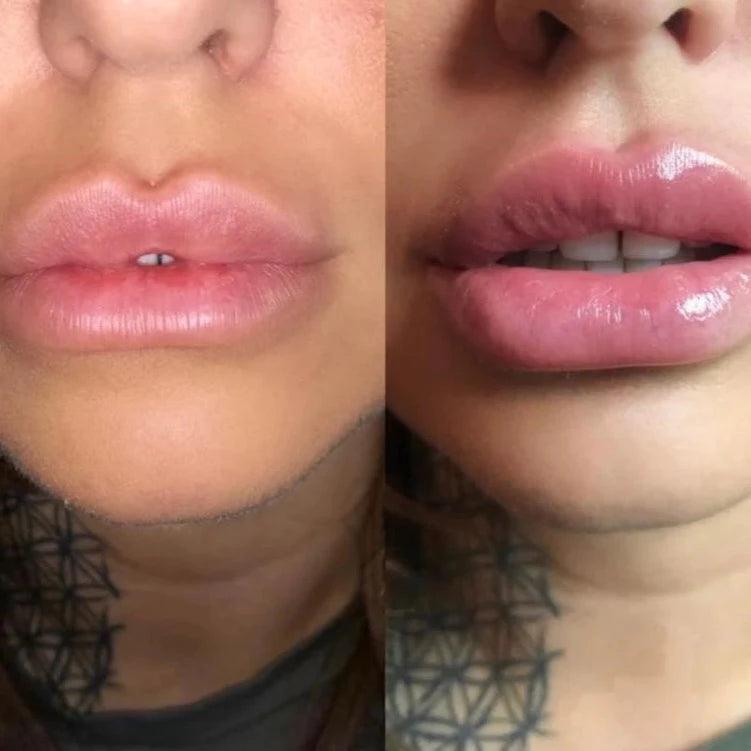 Lip Plumper Max
