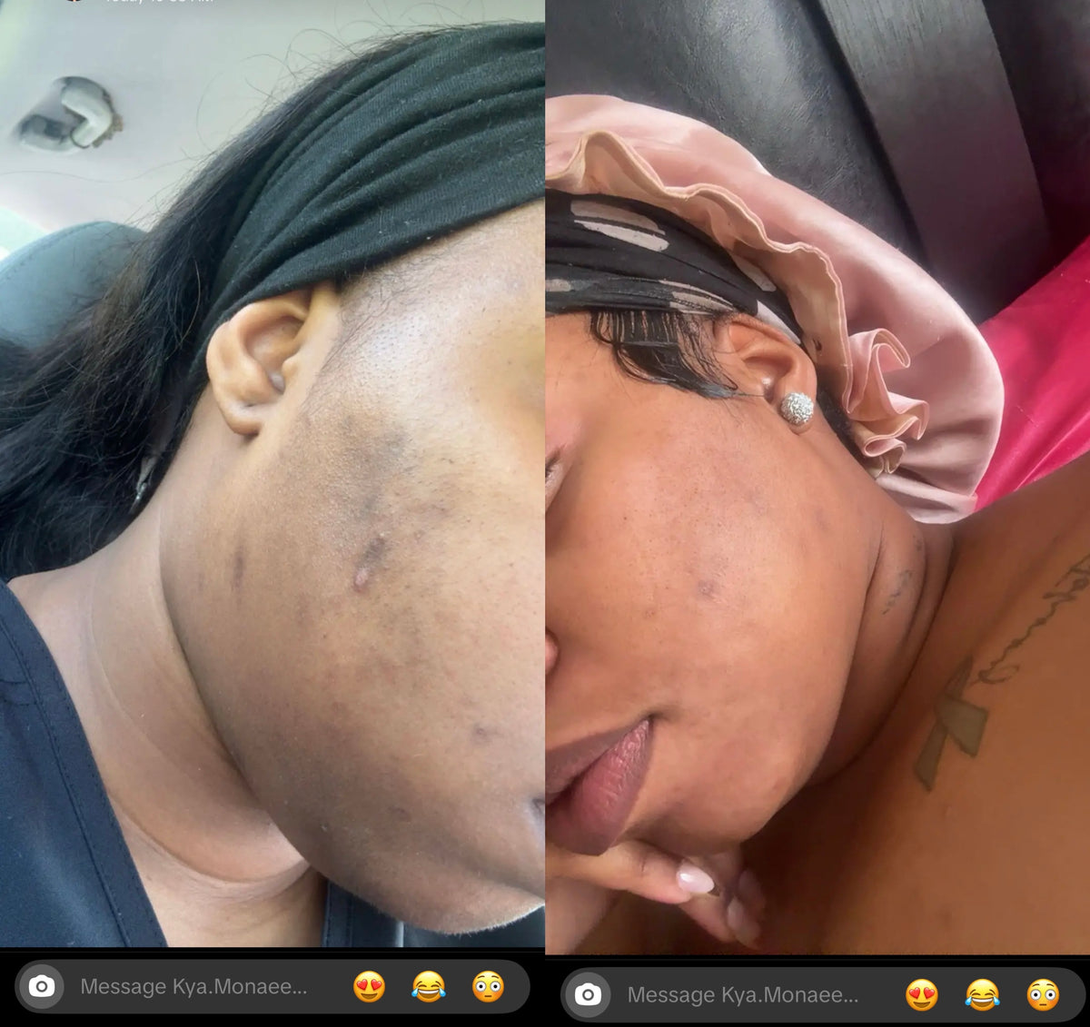 Glow tonic lightning cream