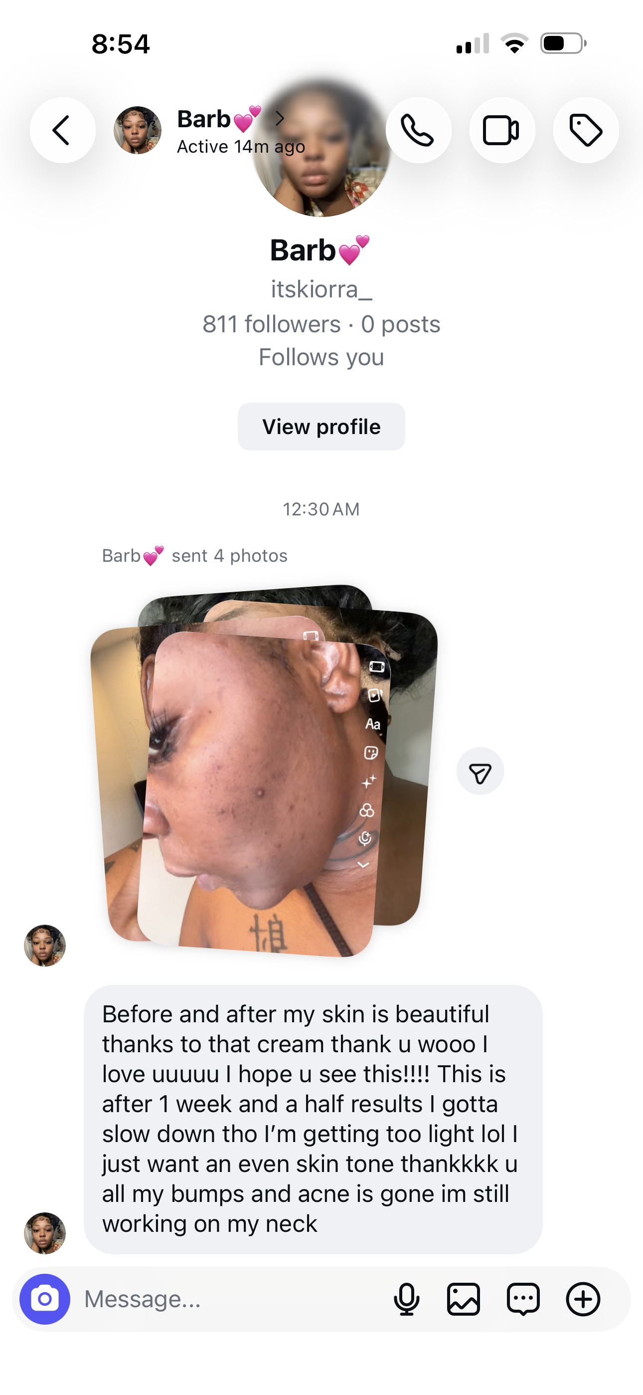 Bleaching cream  + soap￼